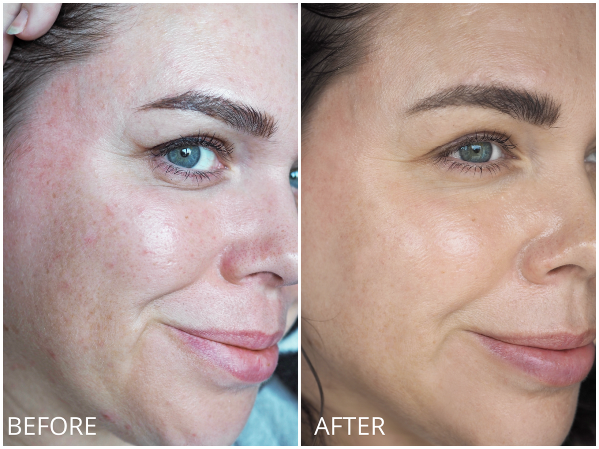 LED Mask Red Light Anti-Wrinkle Rejuvenation